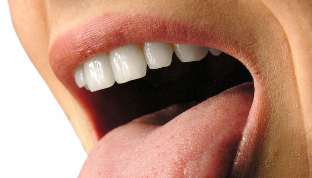 imagenes de causas de halitosis imagenes de causas de halitosis