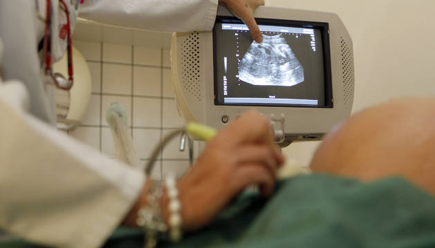 Una ginecóloga hace una ecografía a una mujer embarazada y le muestra el feto en la pantalla del ordenador.