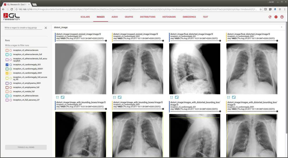 Este es un ejemplo de la inteligencia artificial aplicada a radiografías.