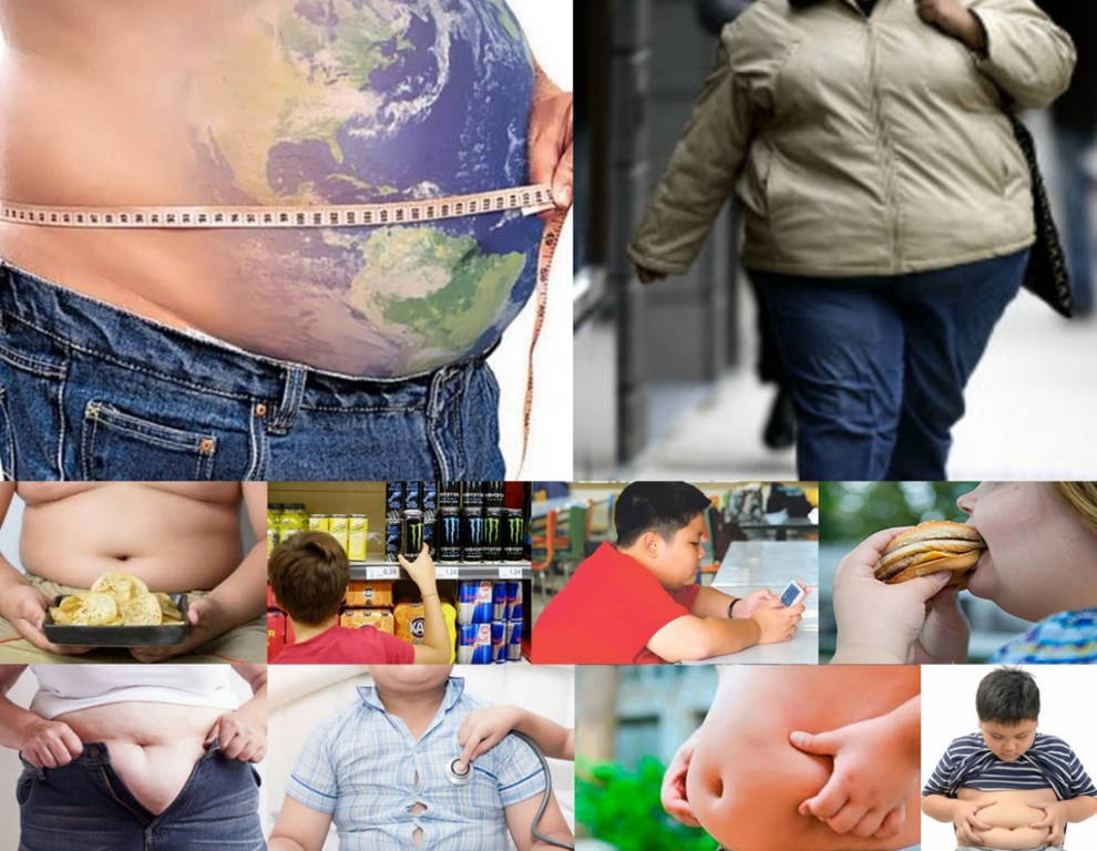 Día Mundial de al Obesidad