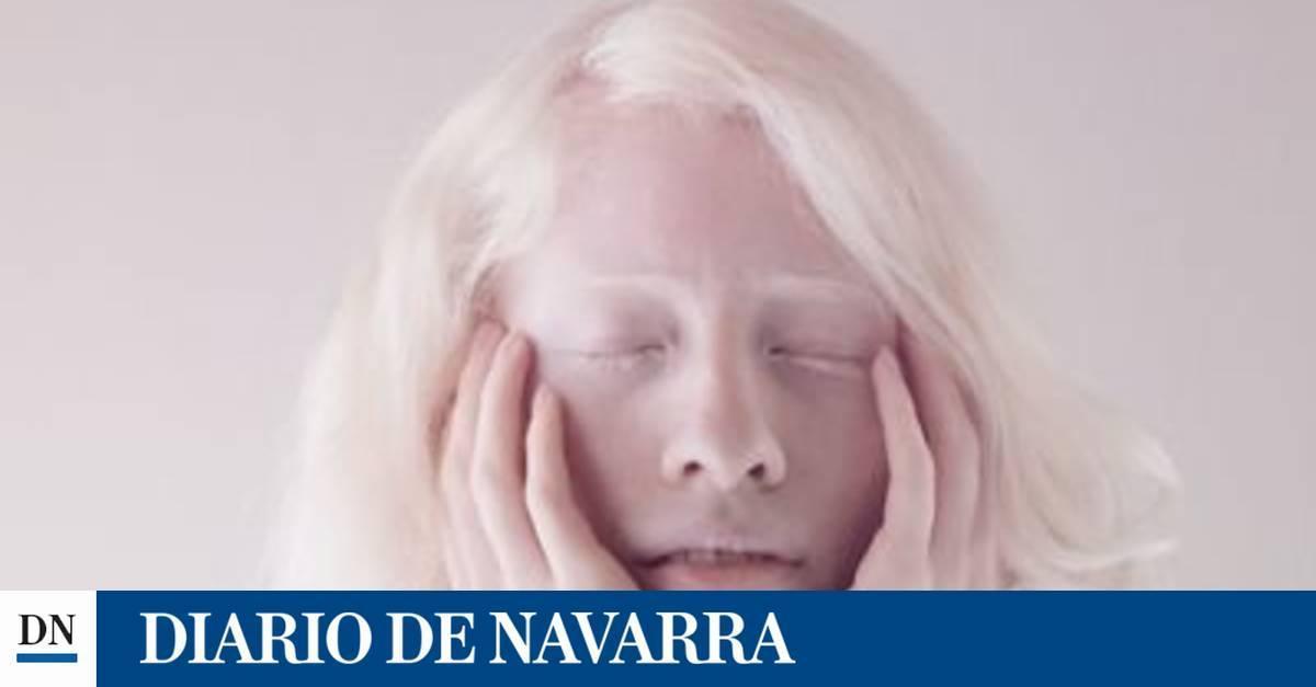 La modelo albina mexicana que aprendió a abrazar su condición - Vimarsana News